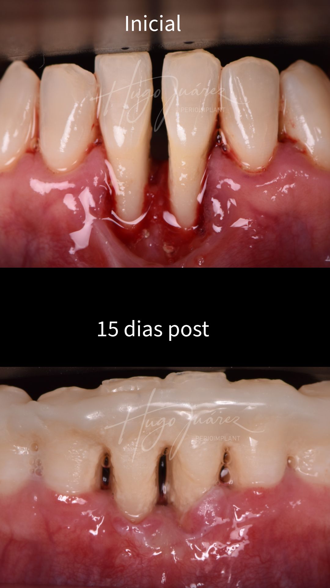 Hugo Juárez César-10