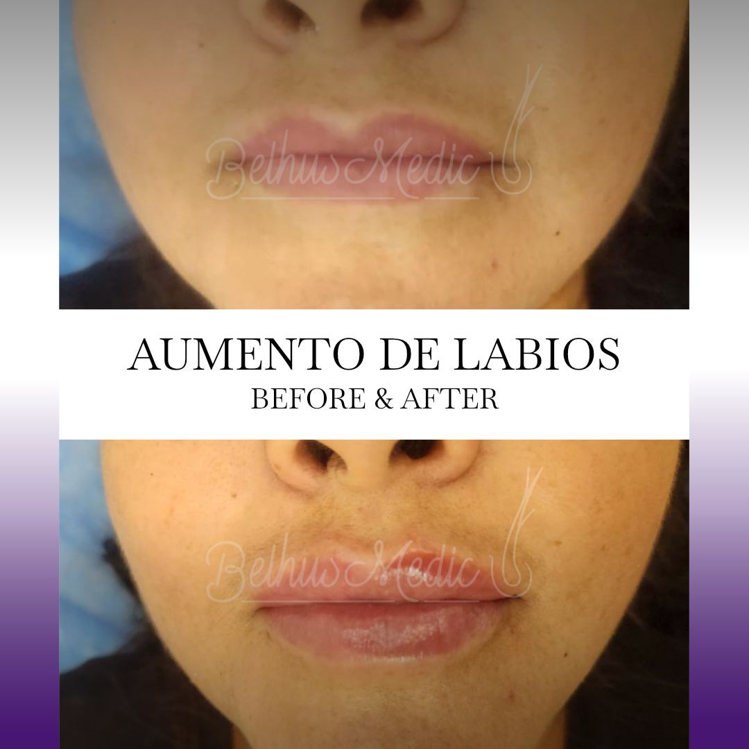 Alejandra Soriano Elorza-101