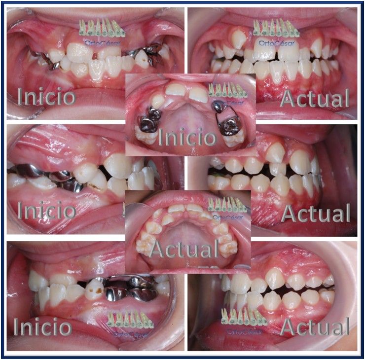 César Augusto Pérez Córdova-53