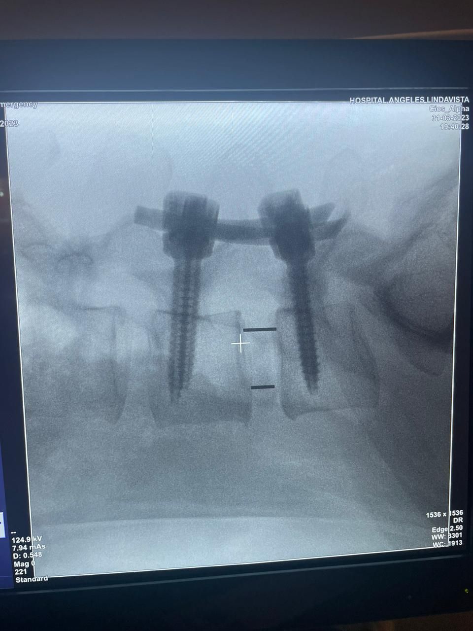 Gerson Reyes Rodríguez-34