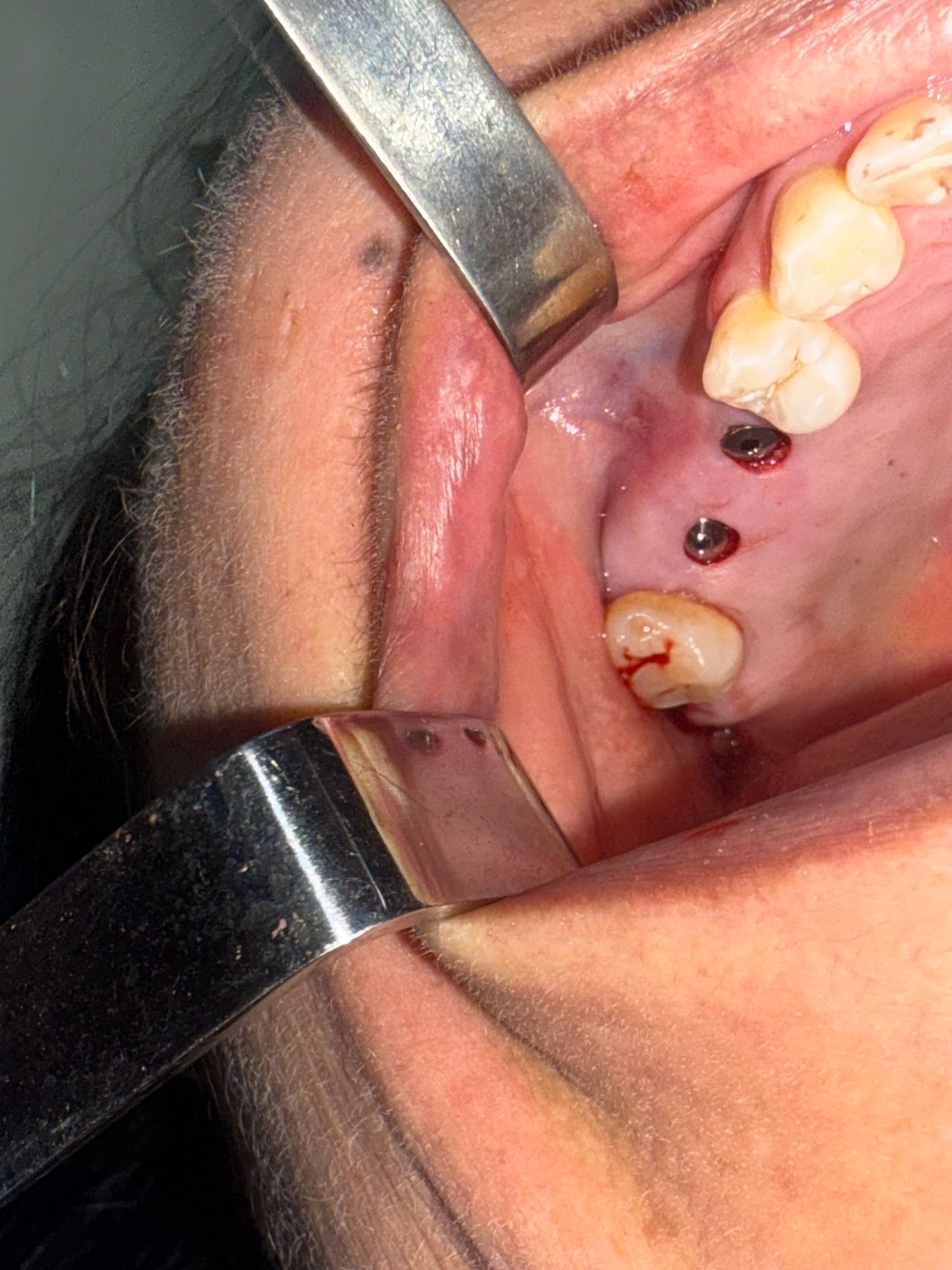 Eduardo López Méndez-60