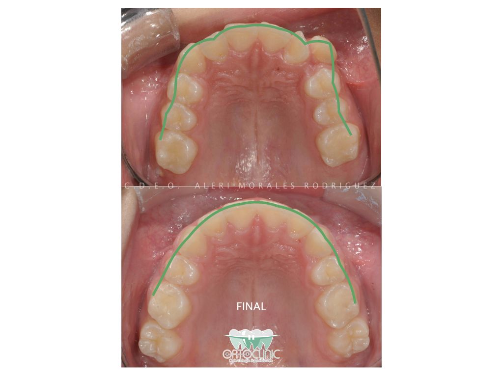 Alerí Morales Rodríguez-5