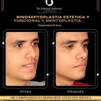 Enrique Serrano Cruz-13