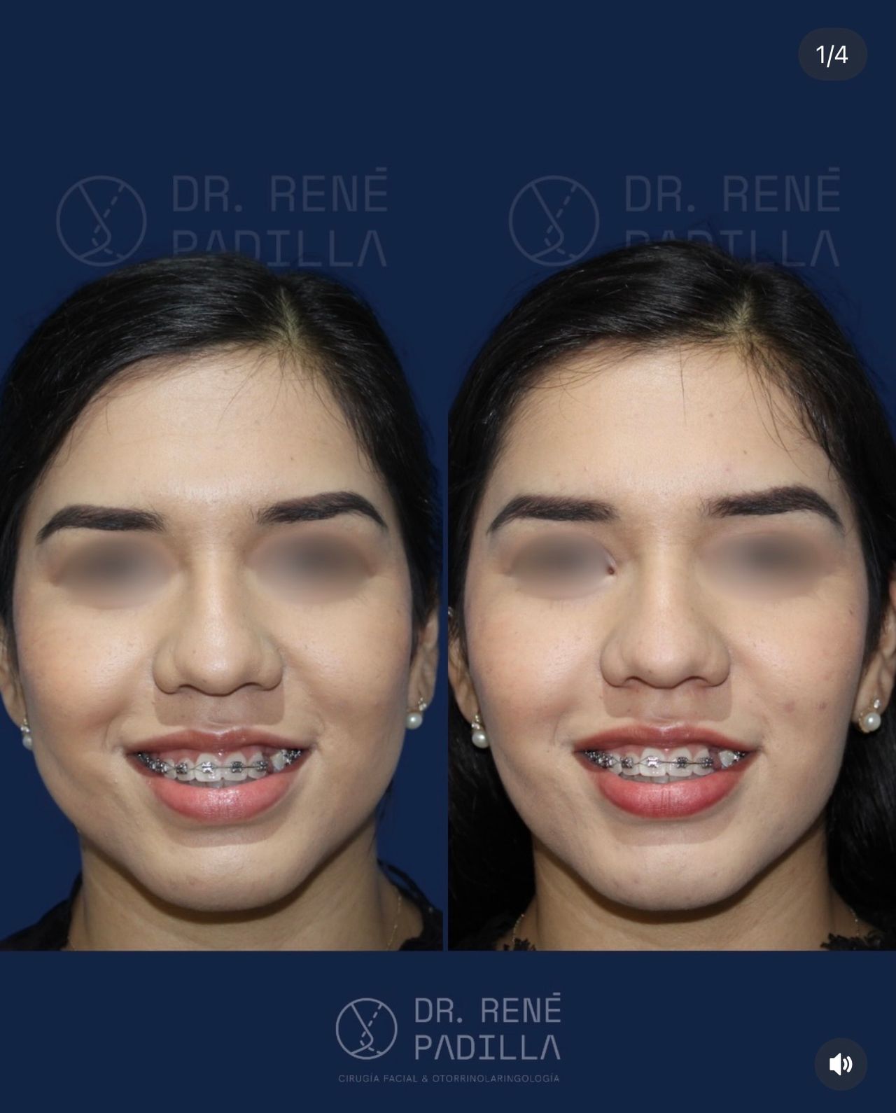 René Emmanuel Padilla López-5