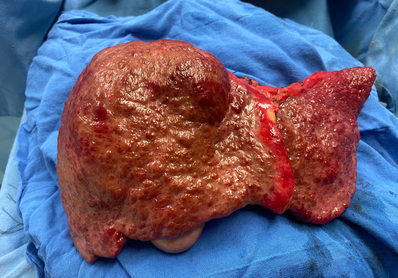 Carlos Rodríguez Montalvo-14