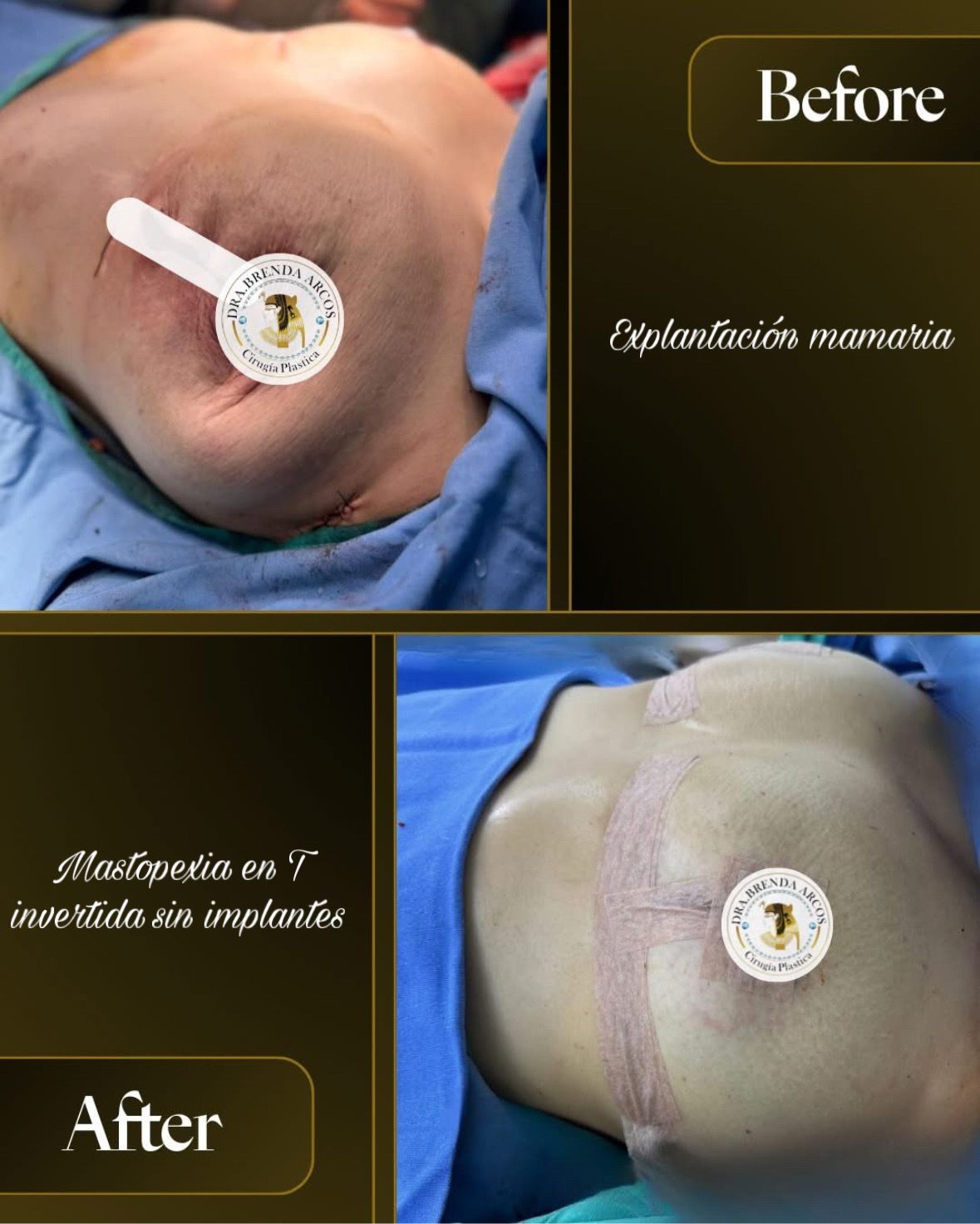 Brenda Arcos Vera-36