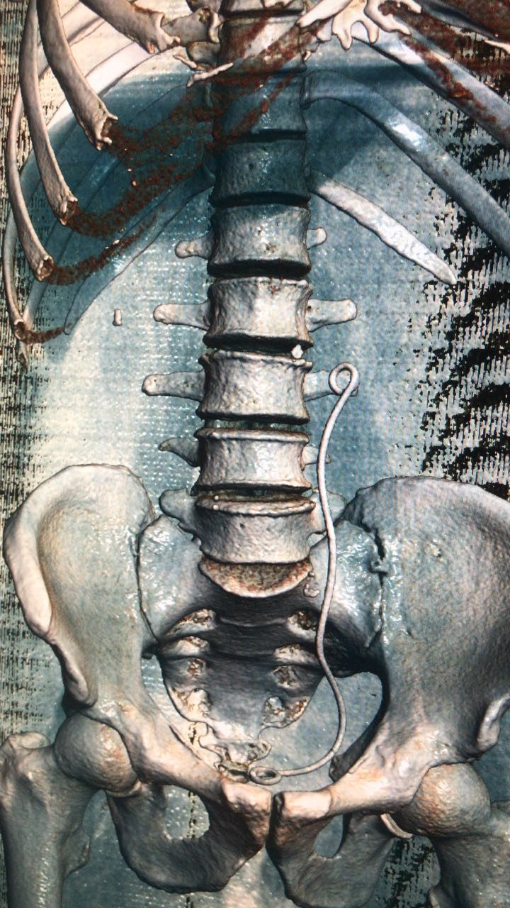 Guillermo Viana Alvarez-10