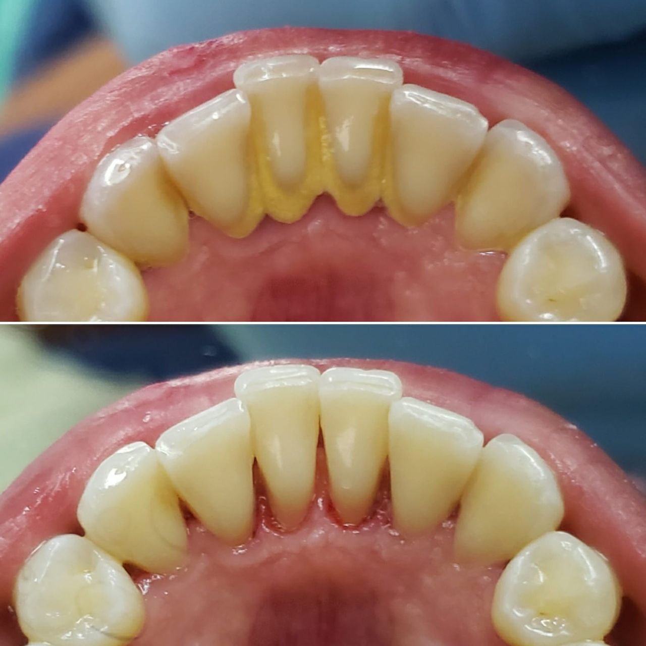 Aide Montserrat Orozco Gutierrez-45