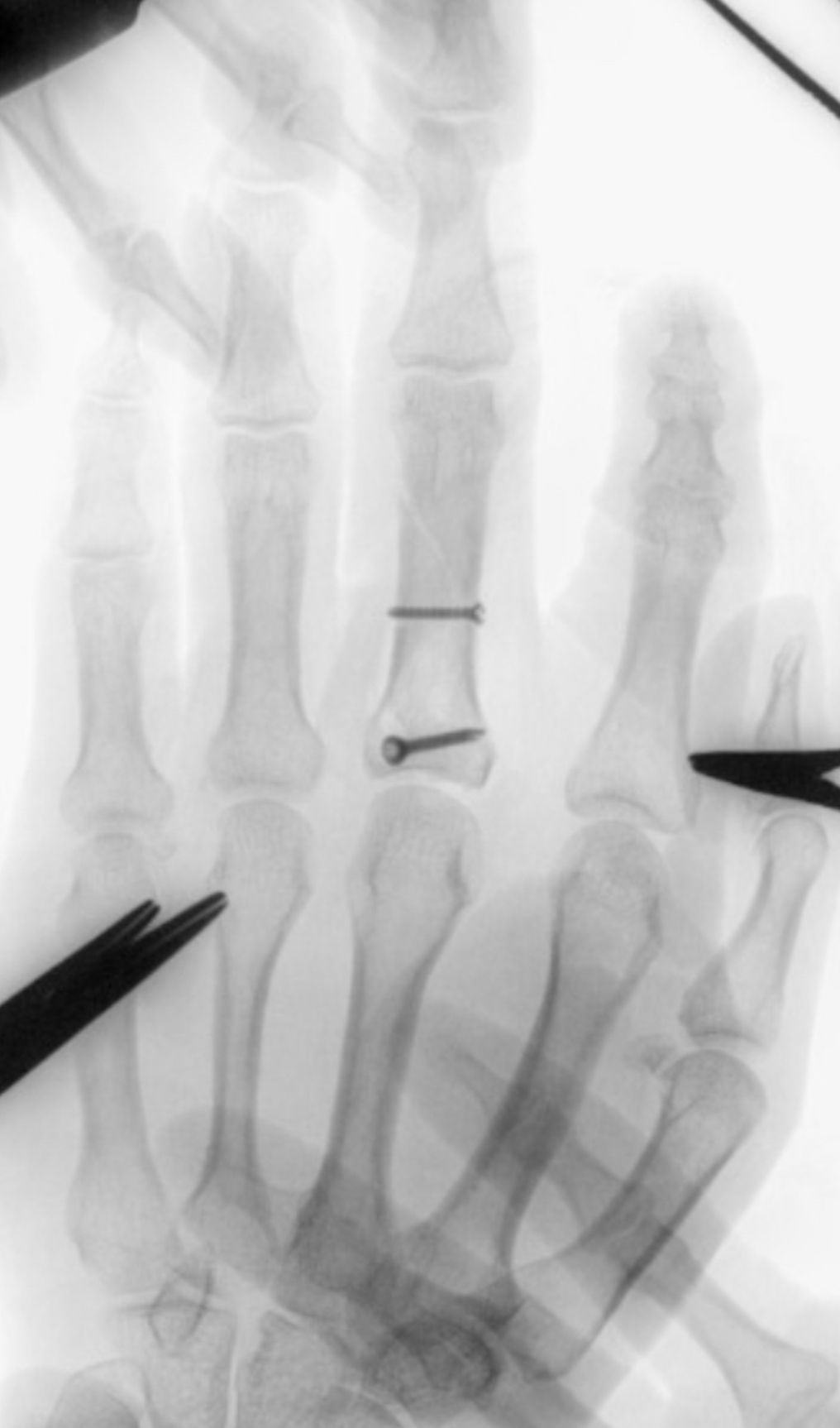 Jorge Antonio Acevedo Valdes-4