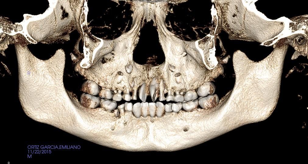 Luis Enrique Cruz Hernández-35