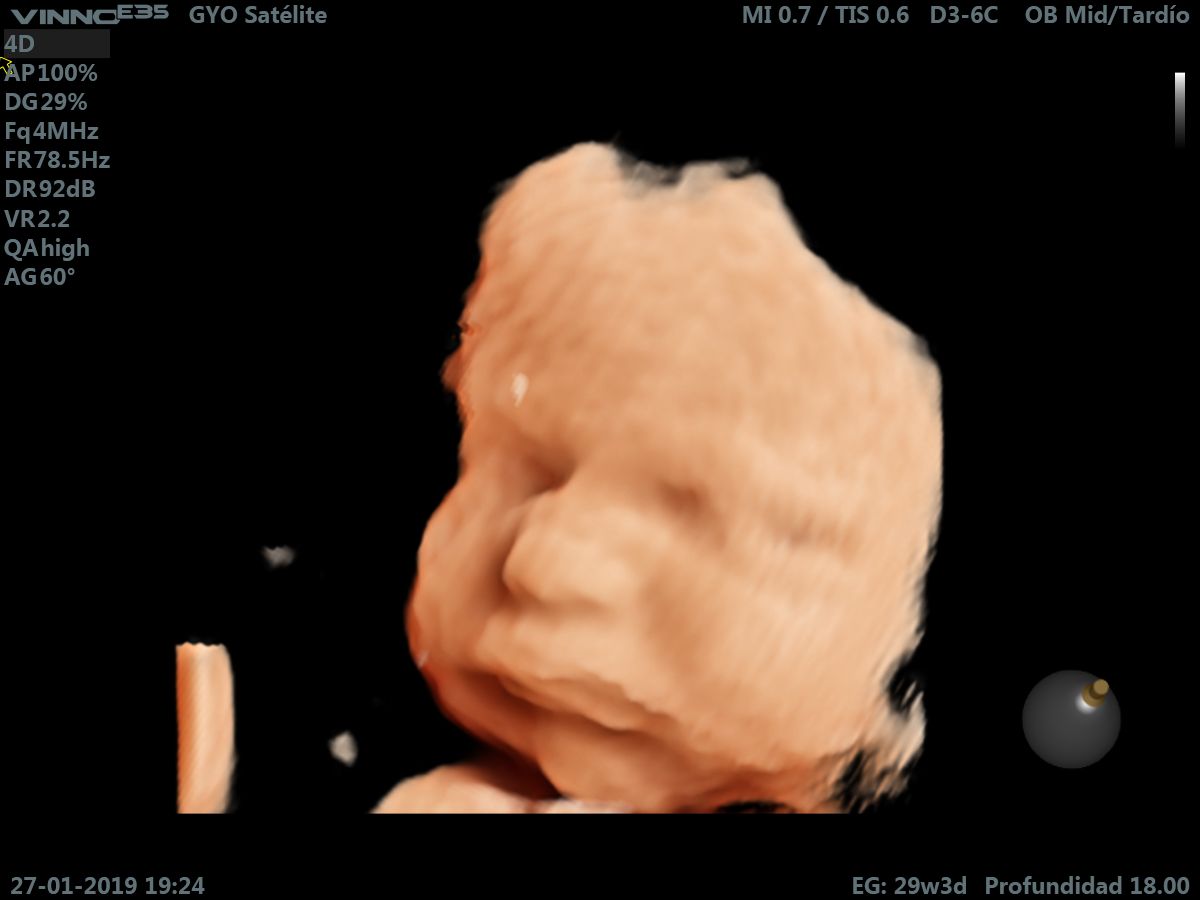 Giovanni Luis Tafelov Vindas-9