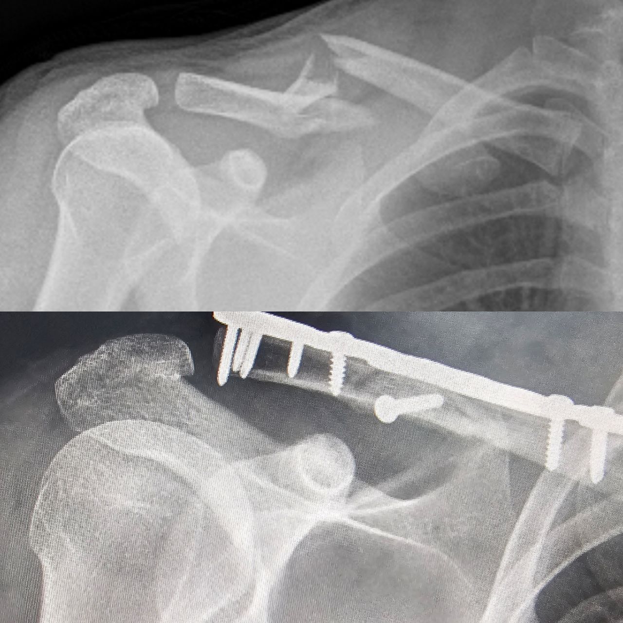 Elías Benjamín Preciado Tovar-4