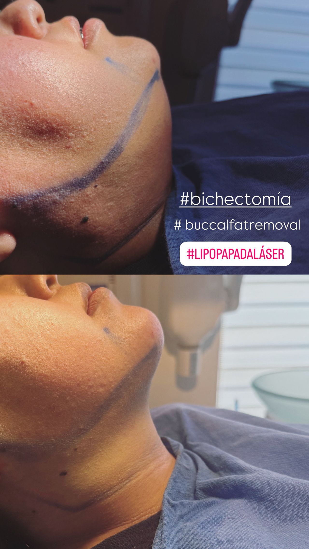 Miguel Angel Aguirre-16