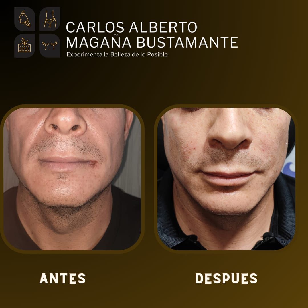 Carlos Alberto Magaña Bustamante-8