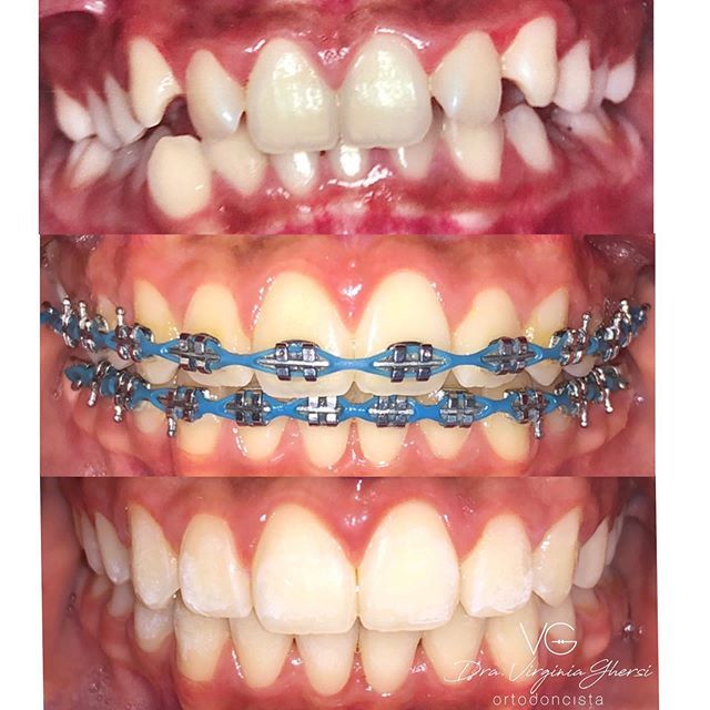 Maria Virginia Ghersi Angulo-10