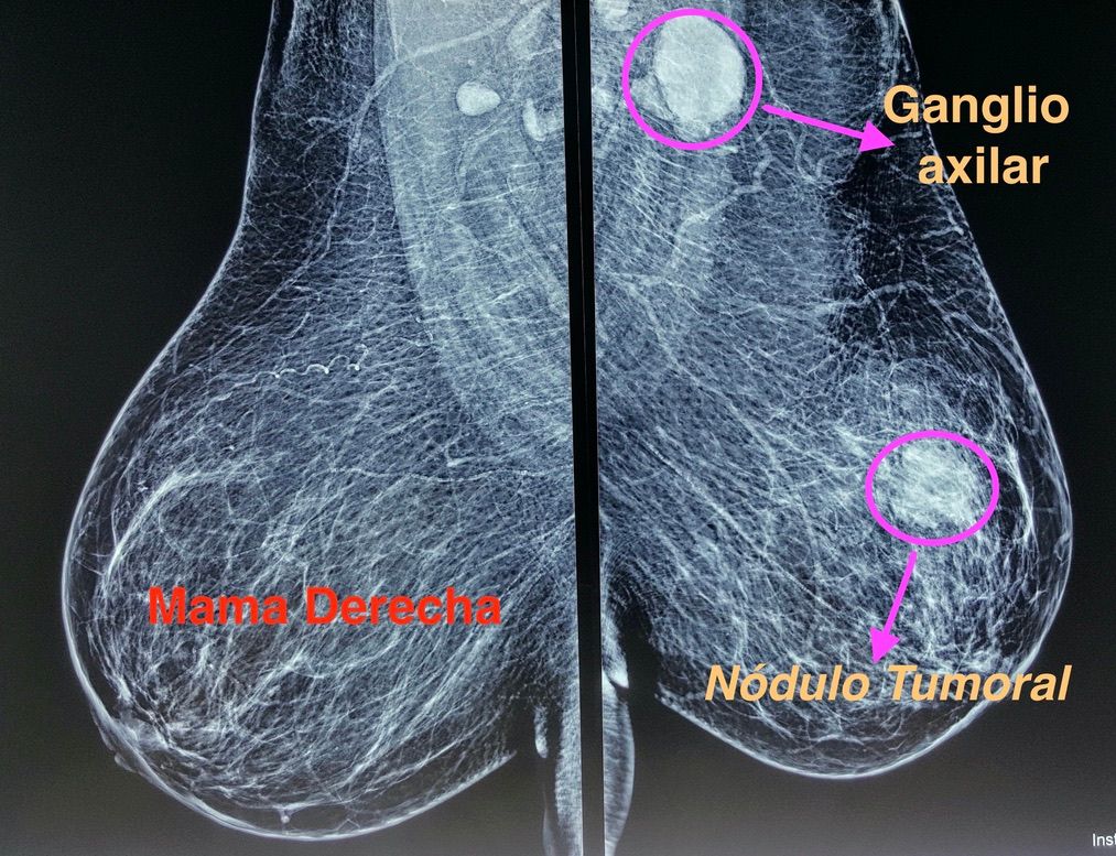 Ángel Millán Juárez-54