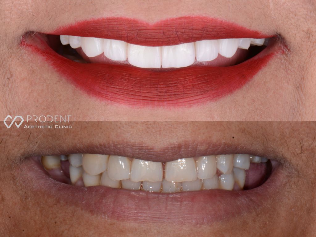 Ramiro Ivan Pérez Murillo-5