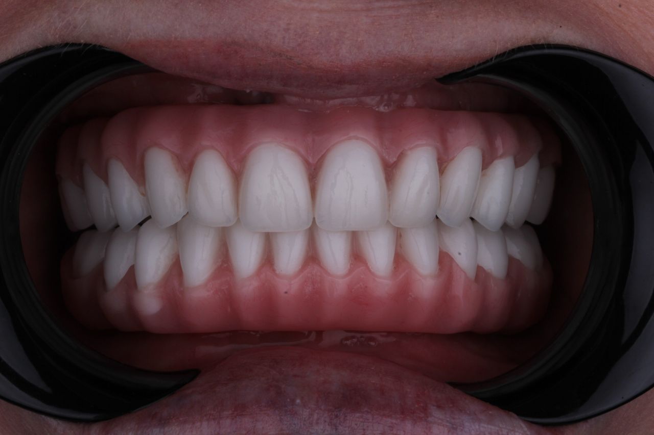 Arturo Mendez Valencia-10