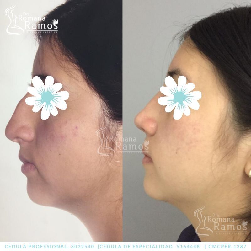 Romana Ramos Cárdenas-32