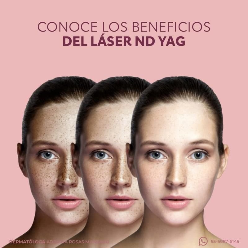 Adriana Rosas Manzano-11