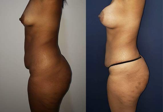 Edgar Ernesto Torres Mejía-16