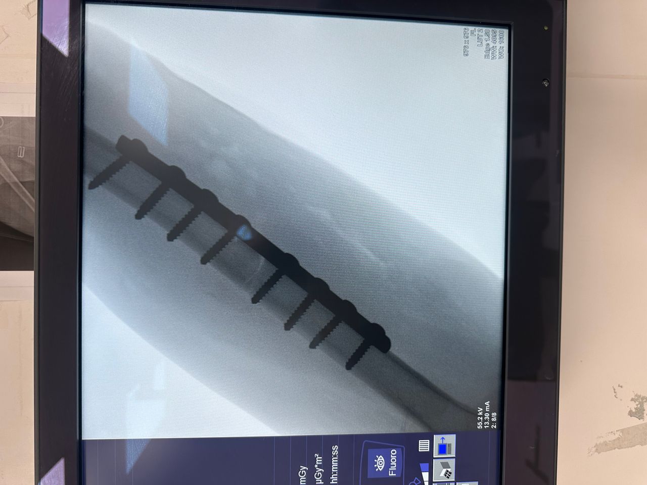 Emmanuel Benitez Biebrich-4