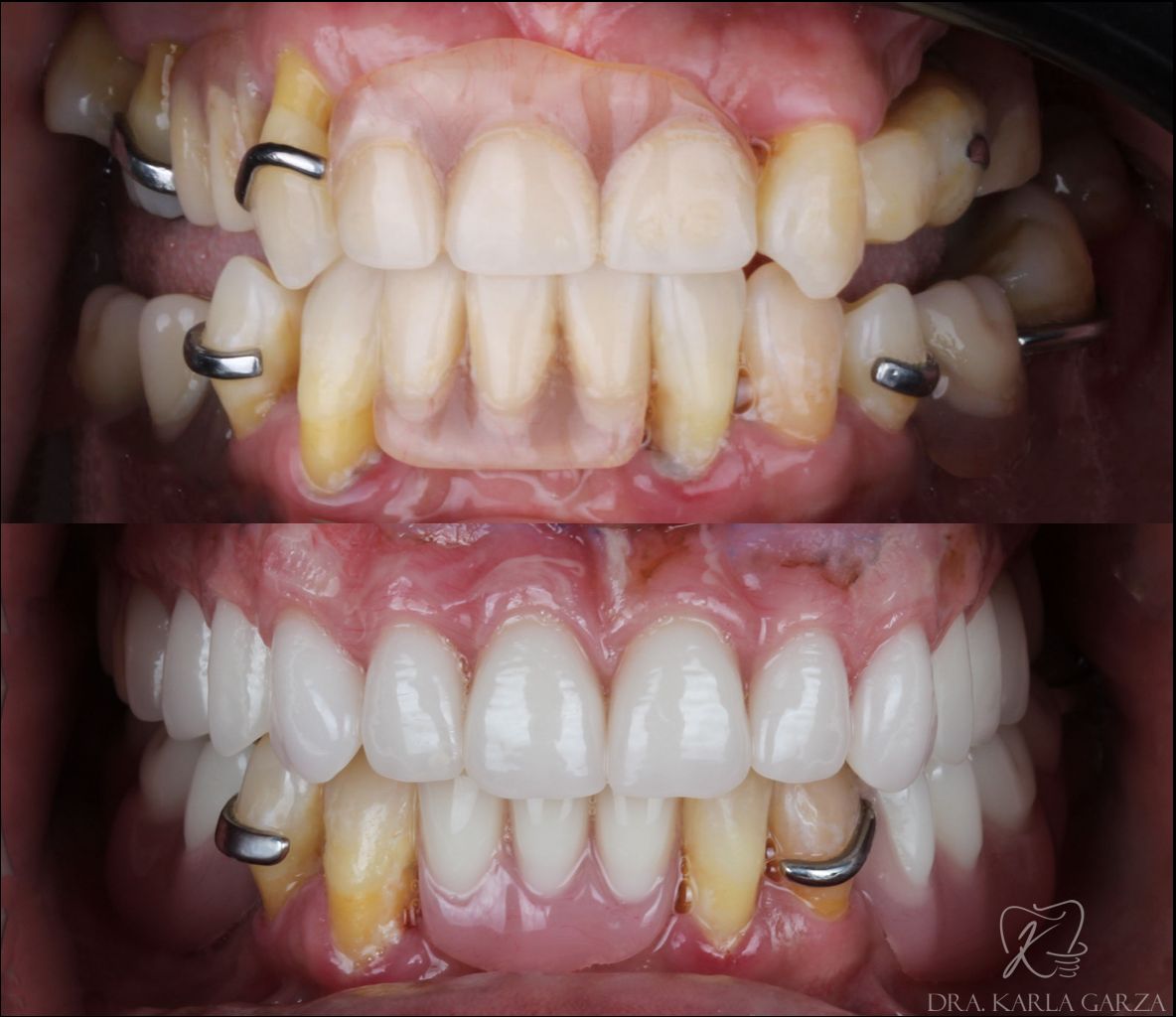 Karla Yaneth Garza Medina-1