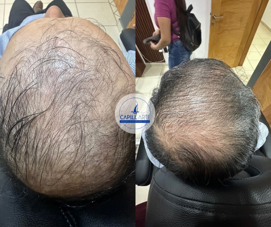 Adrian Hernandez Lopez-23