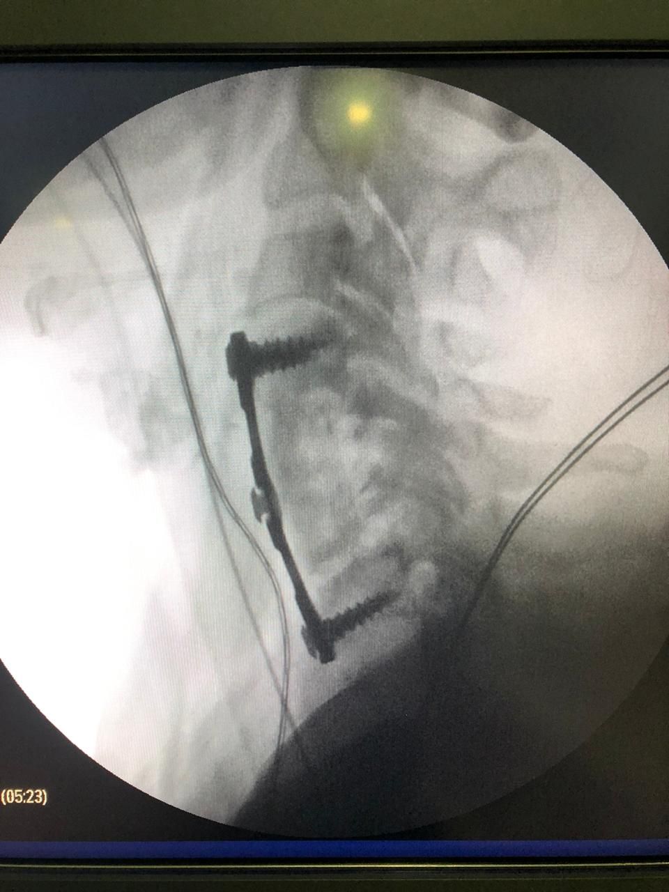 Juan José Luévano De La Cruz-18