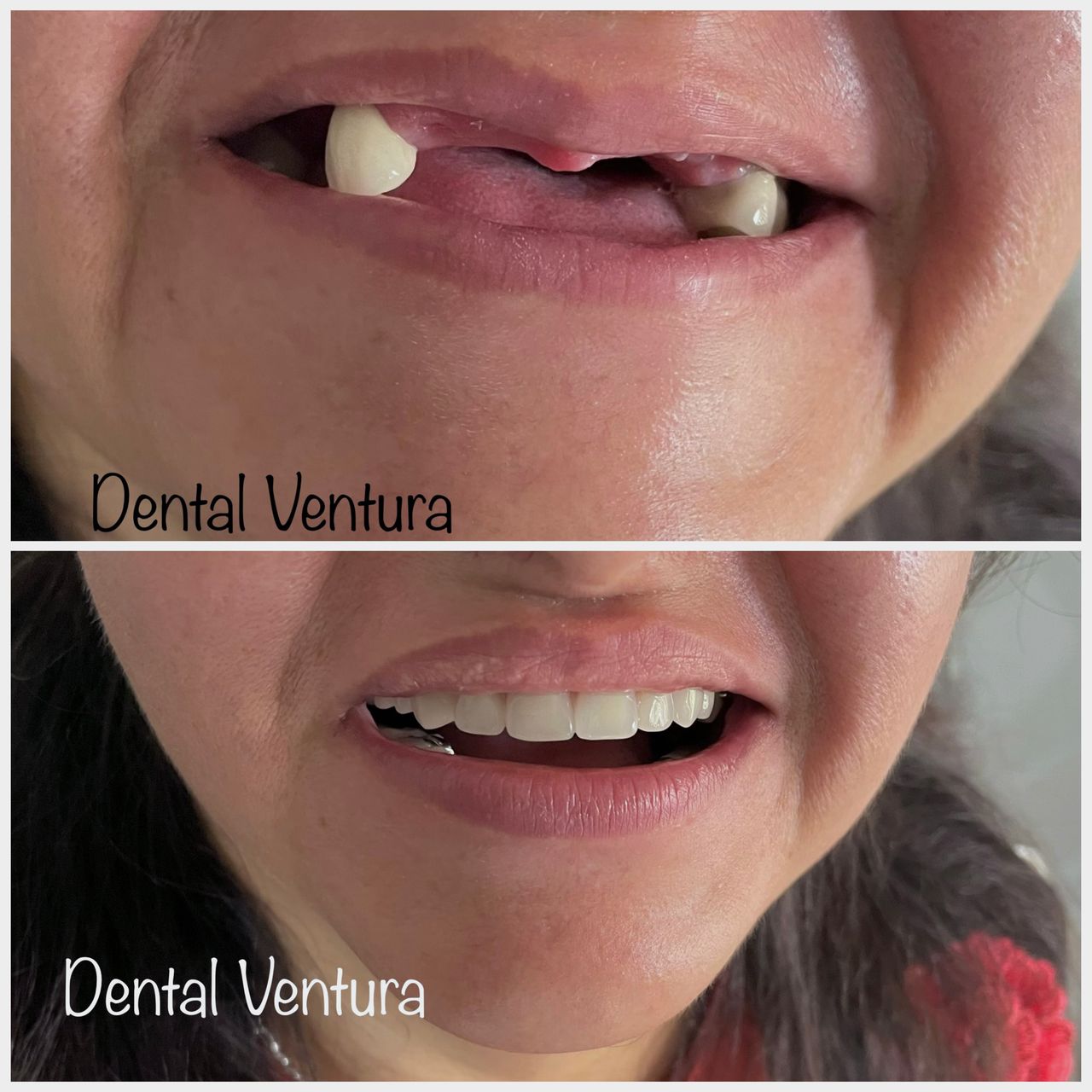 Antonio Cerda Ventura-5