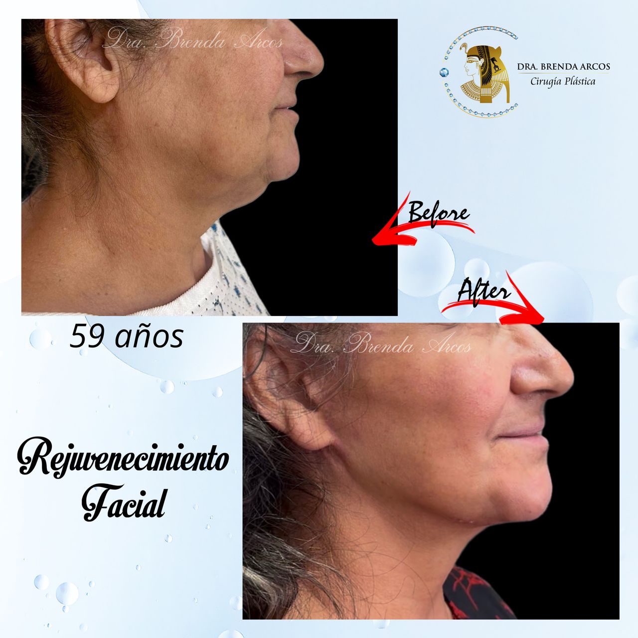 Brenda Arcos Vera-38