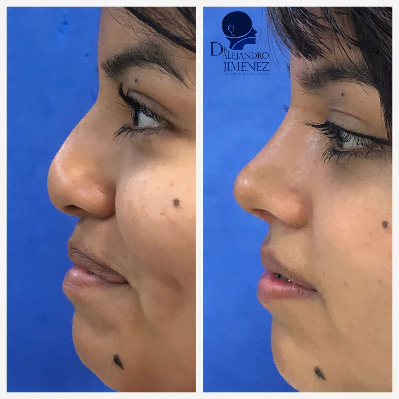 Alejandro Jimenez Garcia-5