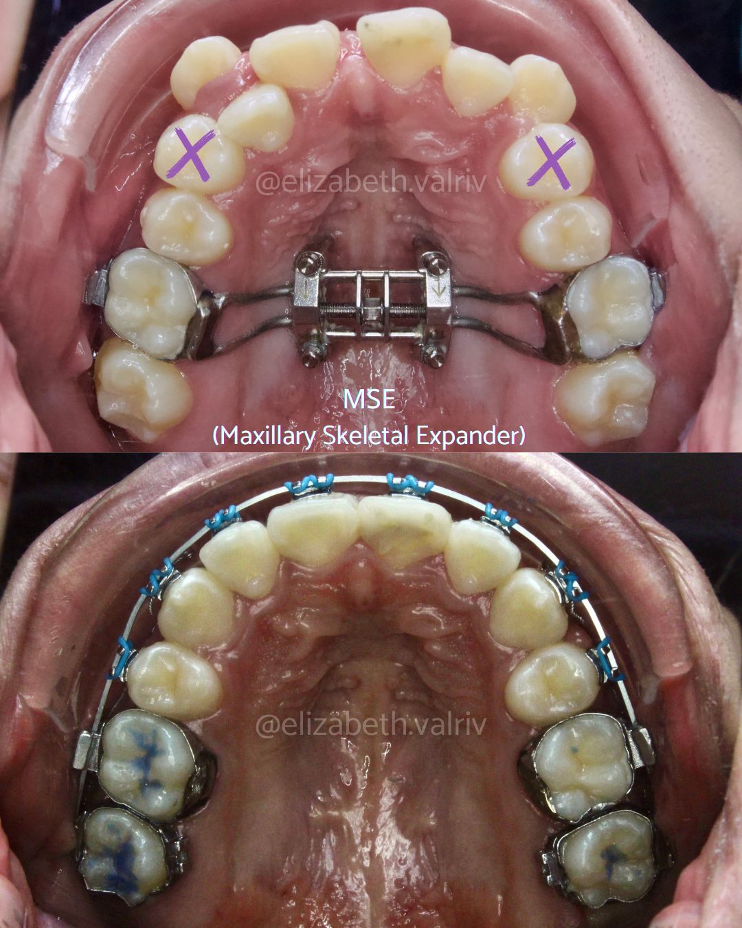 Elizabeth Valenzuela Rivera-9