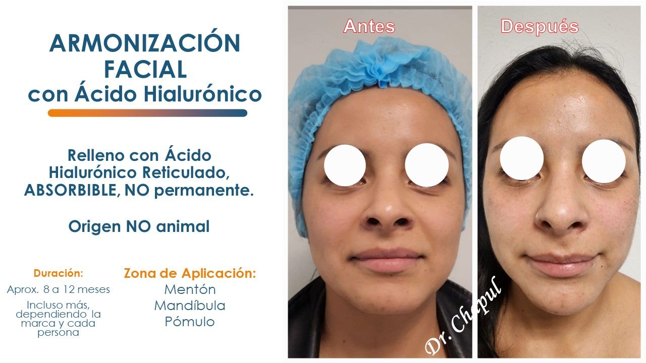 José Luis Muñoz Chapul-5