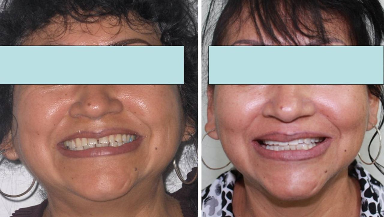 Iris Ocampo Fonseca-13