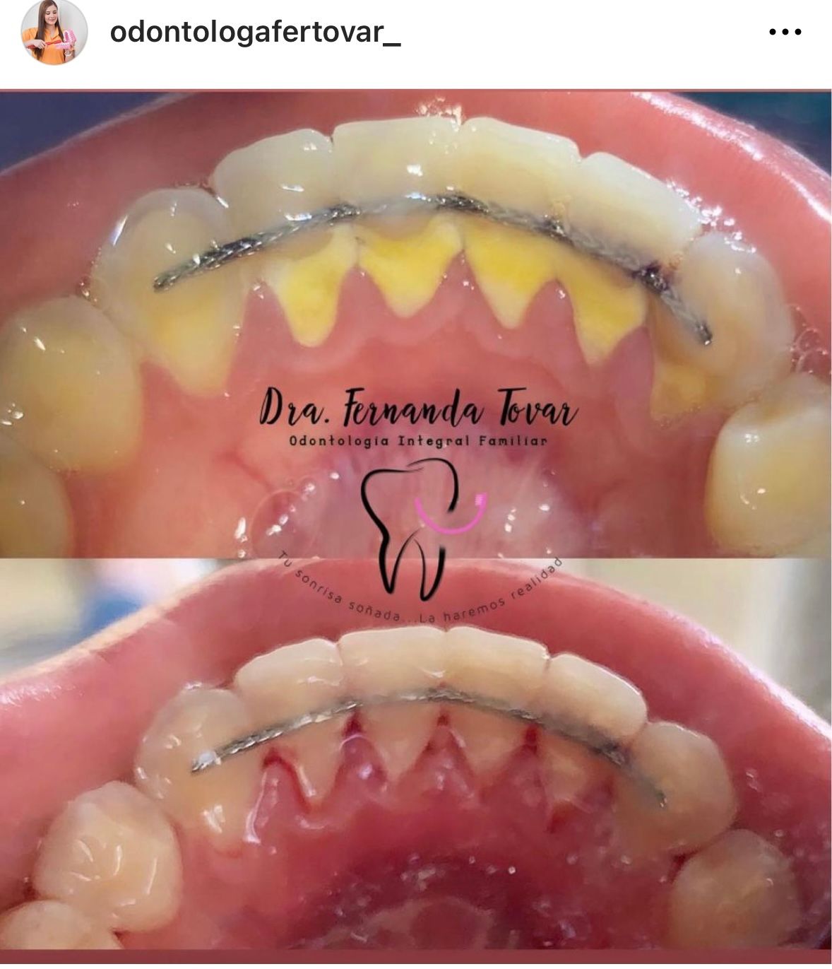 Fernanda Tovar Navarro-17