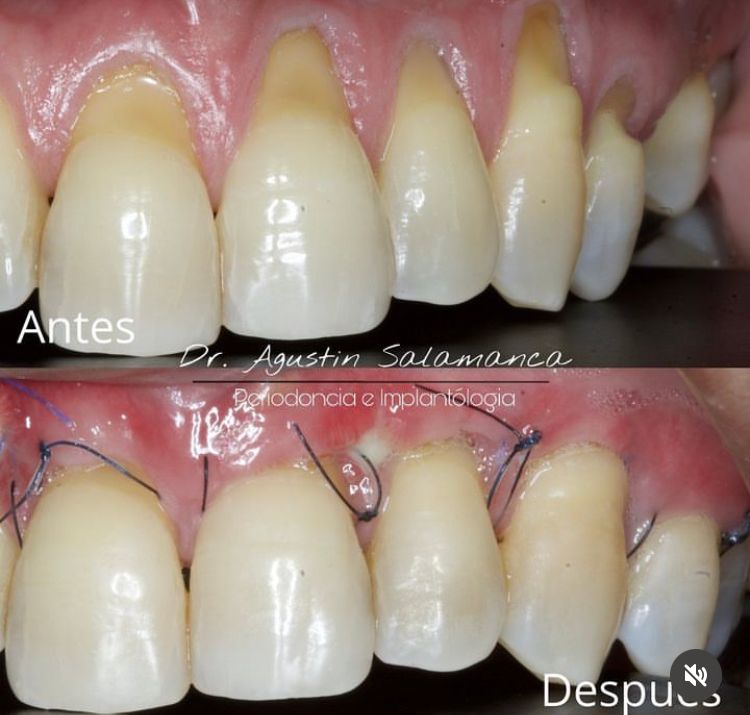 Agustin Salamanca Tapia-18