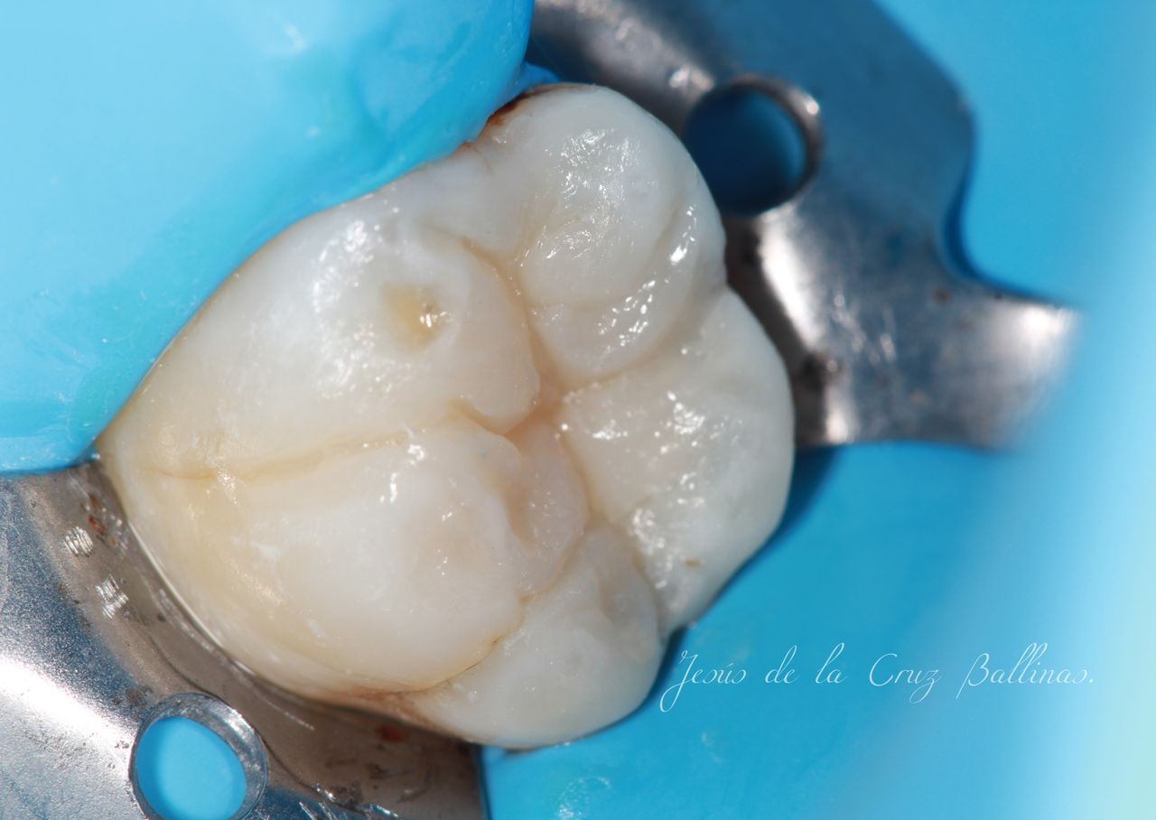 Jesus De La Cruz Ballinas-23