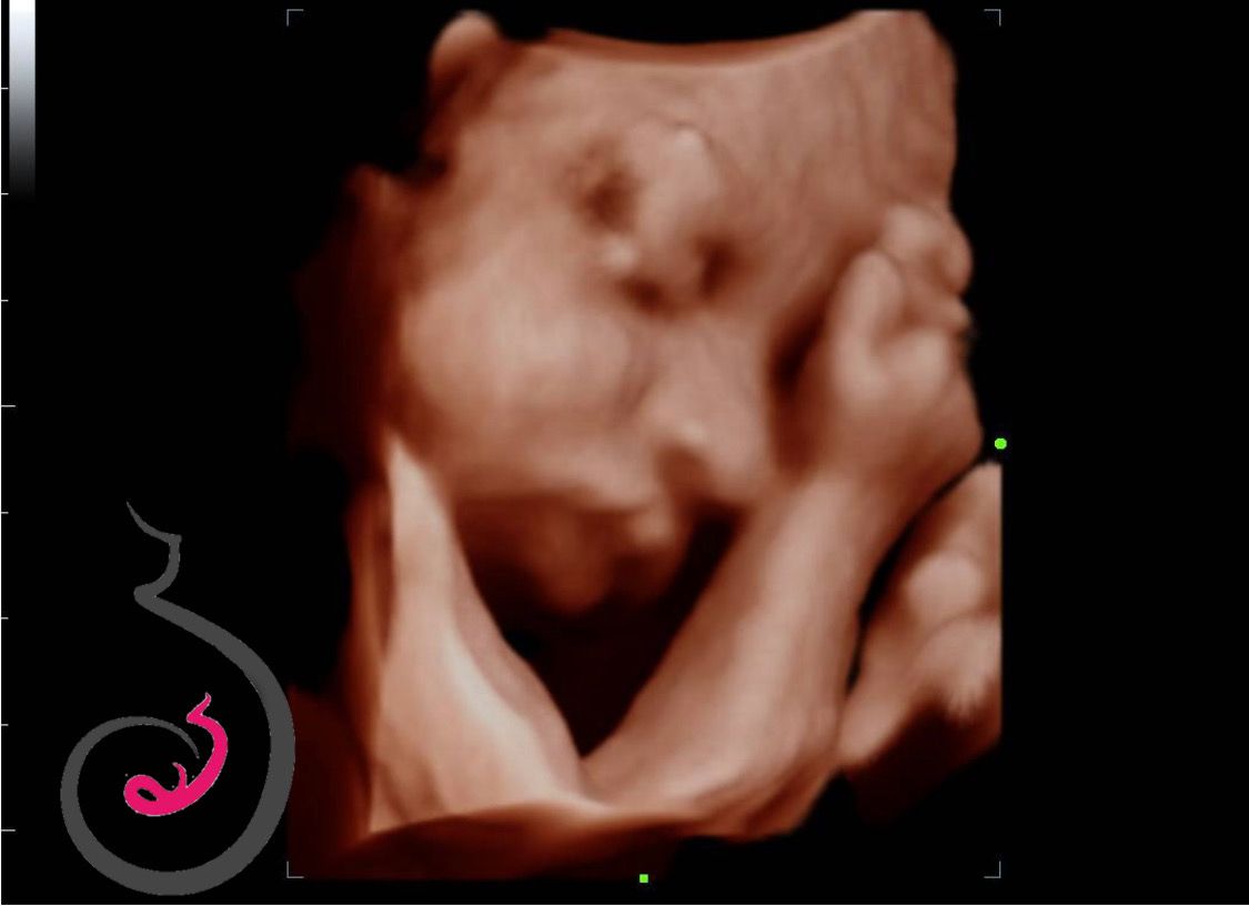 Carlos Humberto Montemayor Villalon-14