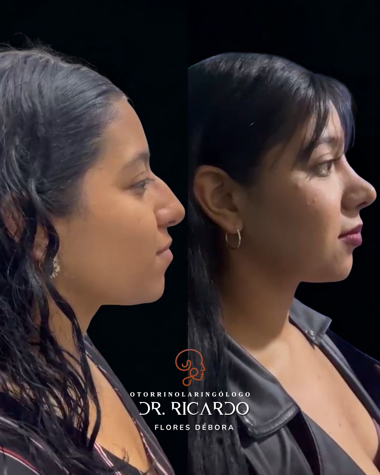 Ricardo Flores Débora-2