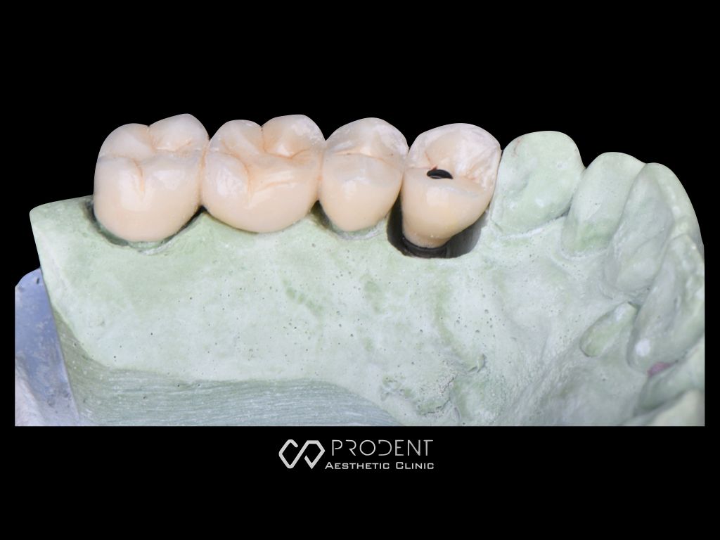 Ramiro Ivan Pérez Murillo-45