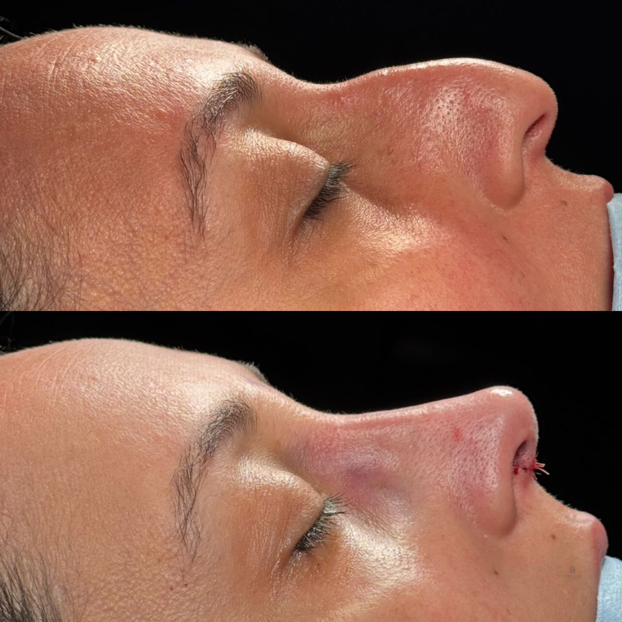 Angel Castro Urquizo-217