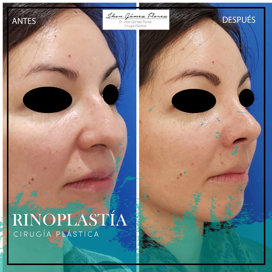 Jhon César Gómez Florez-69