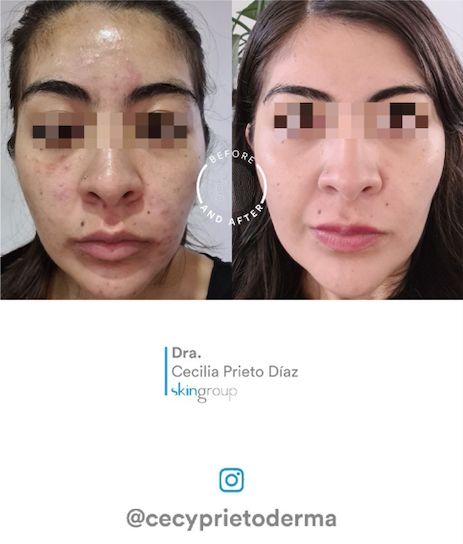 Alma Cecilia Prieto Diaz Preciado-43