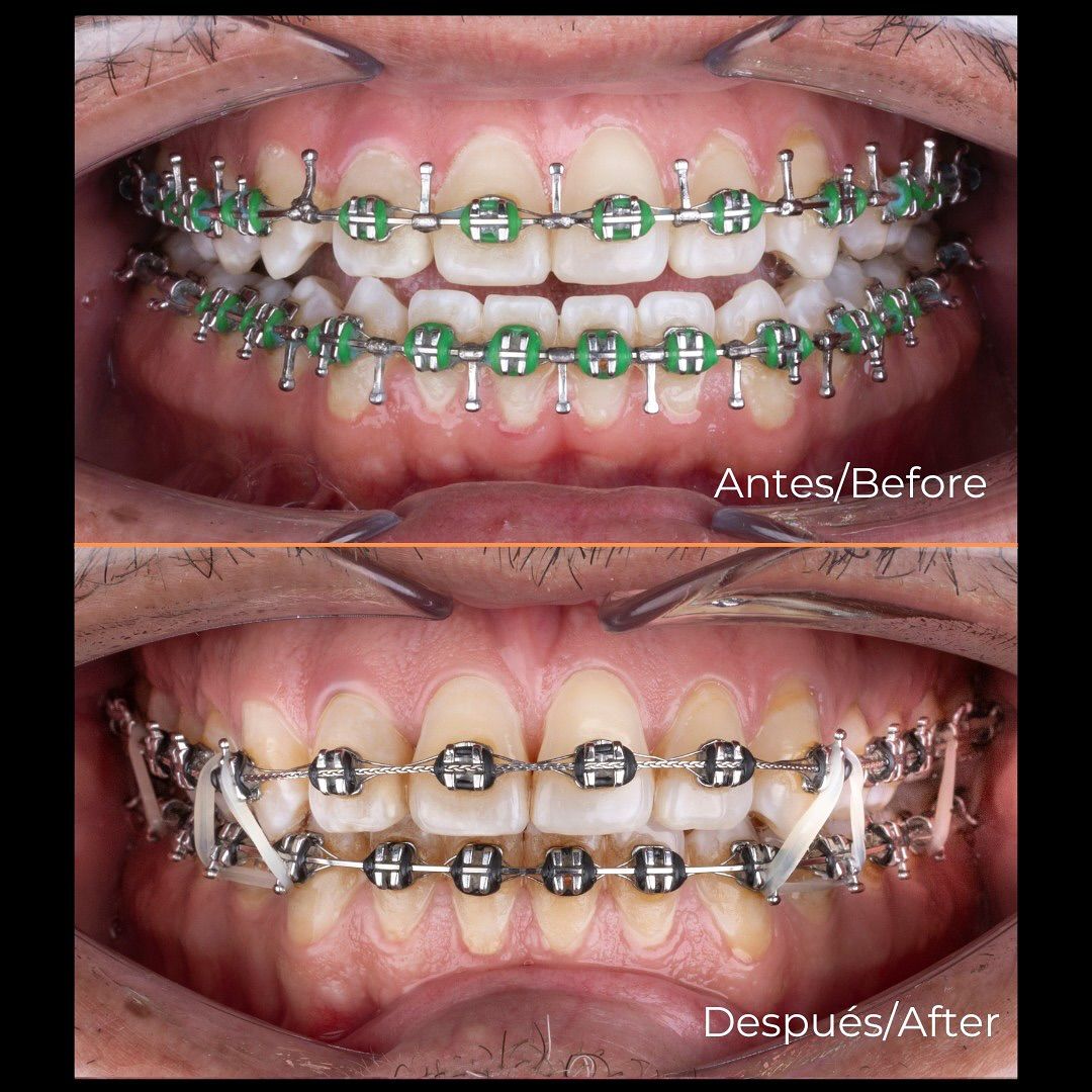 Juan Manuel Olivar Cedeño-9