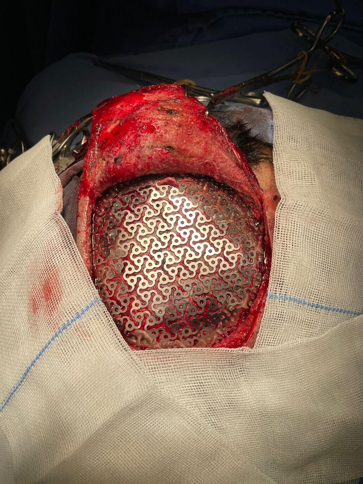 Gerson Reyes Rodríguez-46