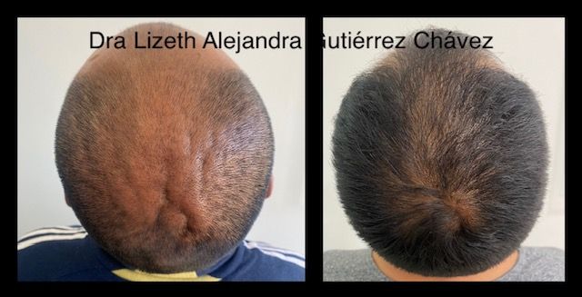 Lizeth Alejandra Gutiérrez Chavéz-4