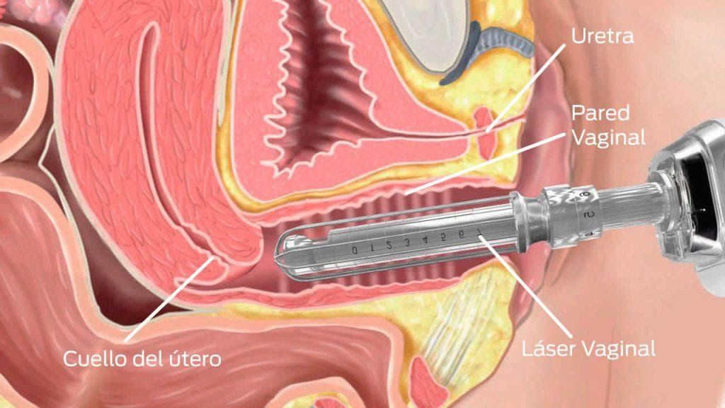 María José Chiriboga Zambrano-7