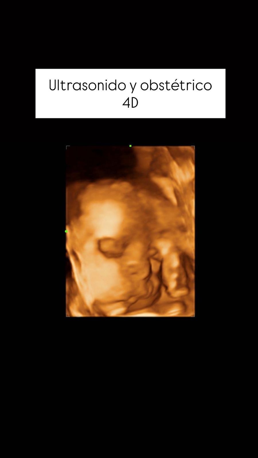 Javier Hernandez Hermenegildo-6