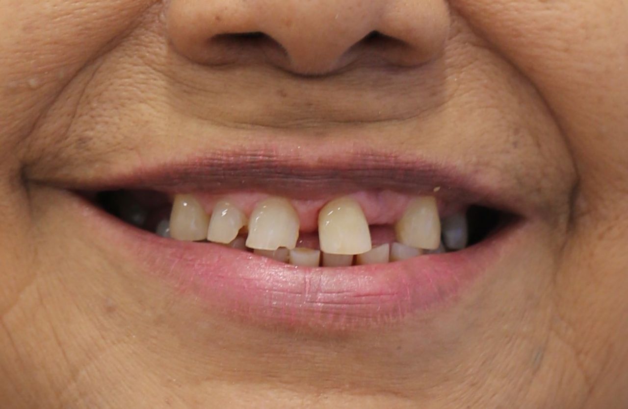 Oscar Alejandro Azcárate Tendilla-8